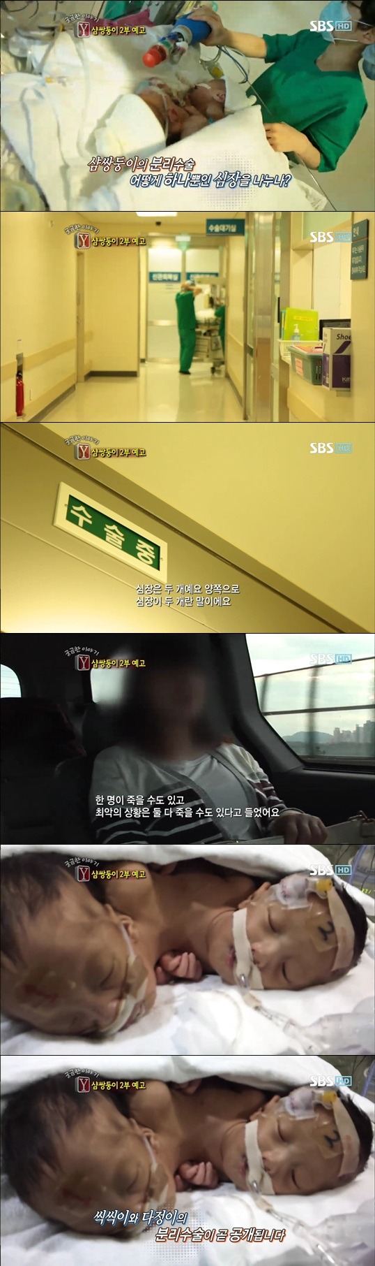 궁금한이야기 Y 샴쌍둥이 이야기 | 인스티즈