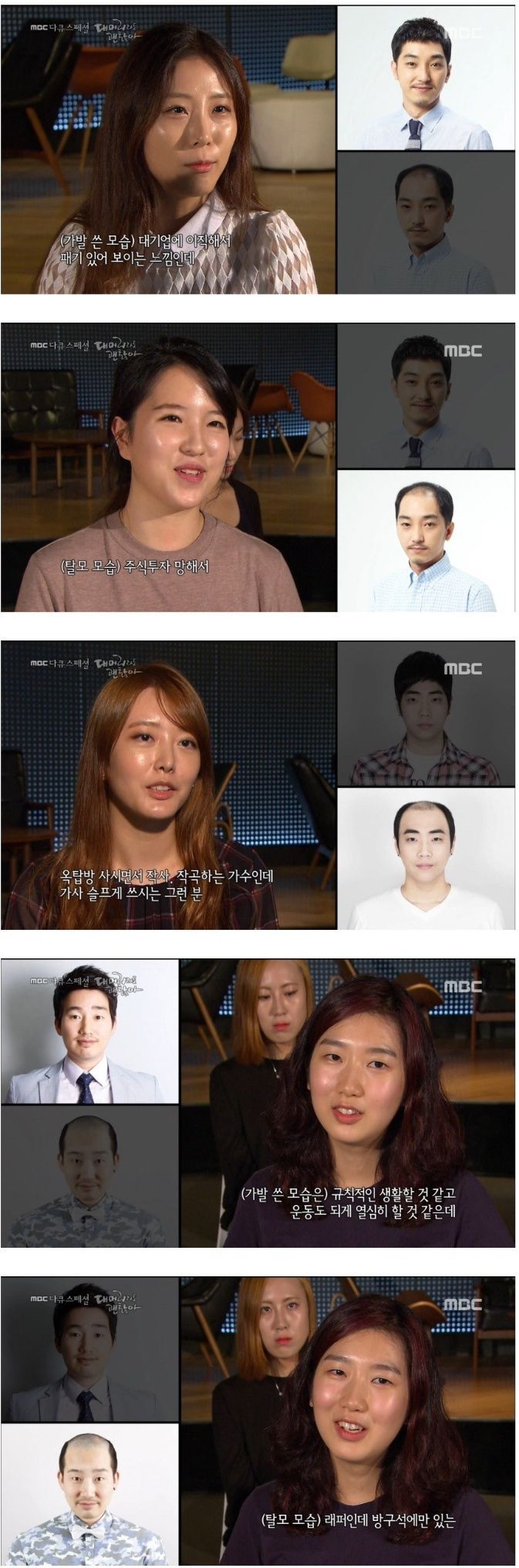 탈모인을 바라보는 여성들의 시선 | 인스티즈