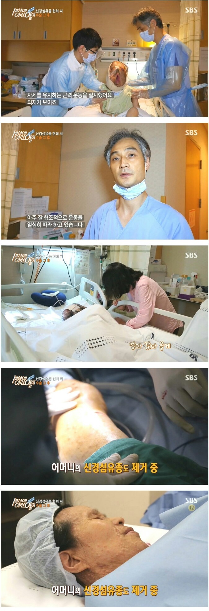  sbs 세상에 이런 일이 현희씨 수술 그 후.jpg | 인스티즈