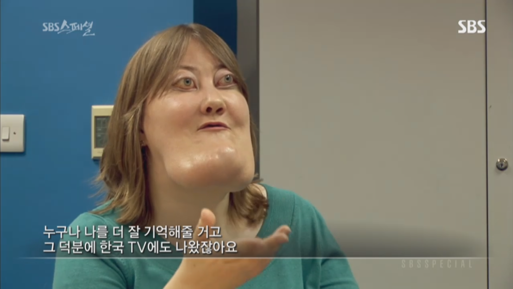 기형적 턱을 가진 여자 비키 라이트가 성형수술을 하지 않는 이유 | 인스티즈