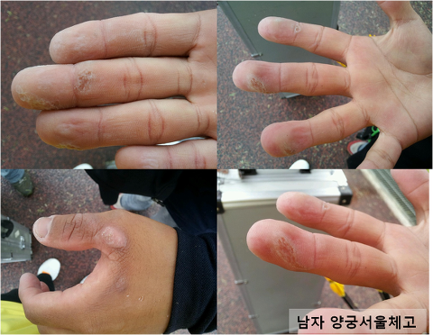 운동선수들의 손바닥 사진 | 인스티즈