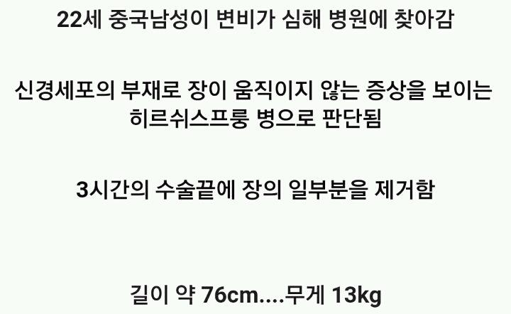 혐주의)변비 걸린 남성의 장을 절제해보니 무게가 13kg | 인스티즈