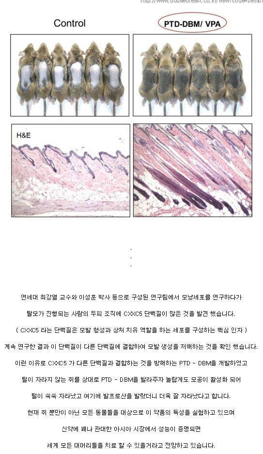 대머리들 쑤아리 질러! | 인스티즈