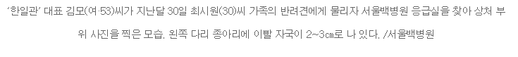 한일관 대표 종아리 상처 사진.jpg (혐오주의) | 인스티즈