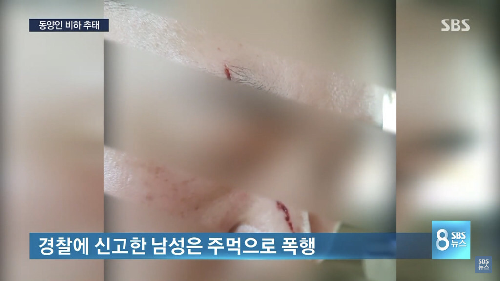 흑인이 인종차별 하지 않는다고 생각하는 것도 일종의 편견임 | 인스티즈